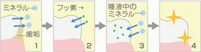 フッ素塗布